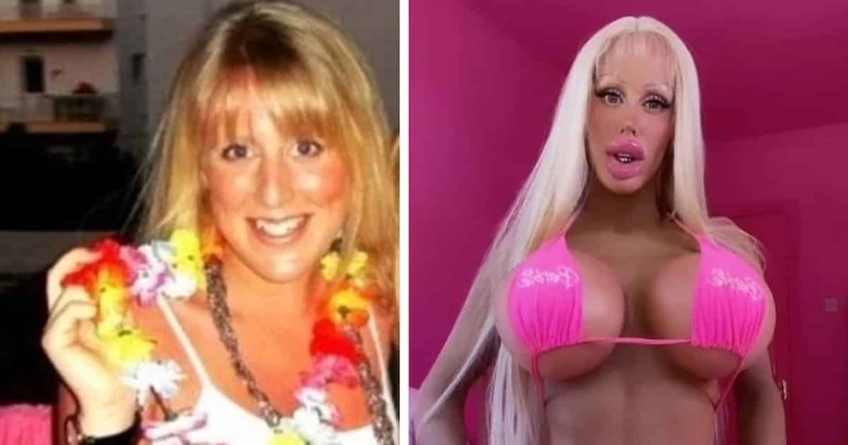 Questa donna ha speso oltre 115.000 euro in chirurgia per somigliare a una bambola Barbie