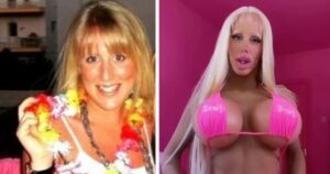 Ha speso oltre 115.000 euro in chirurgia