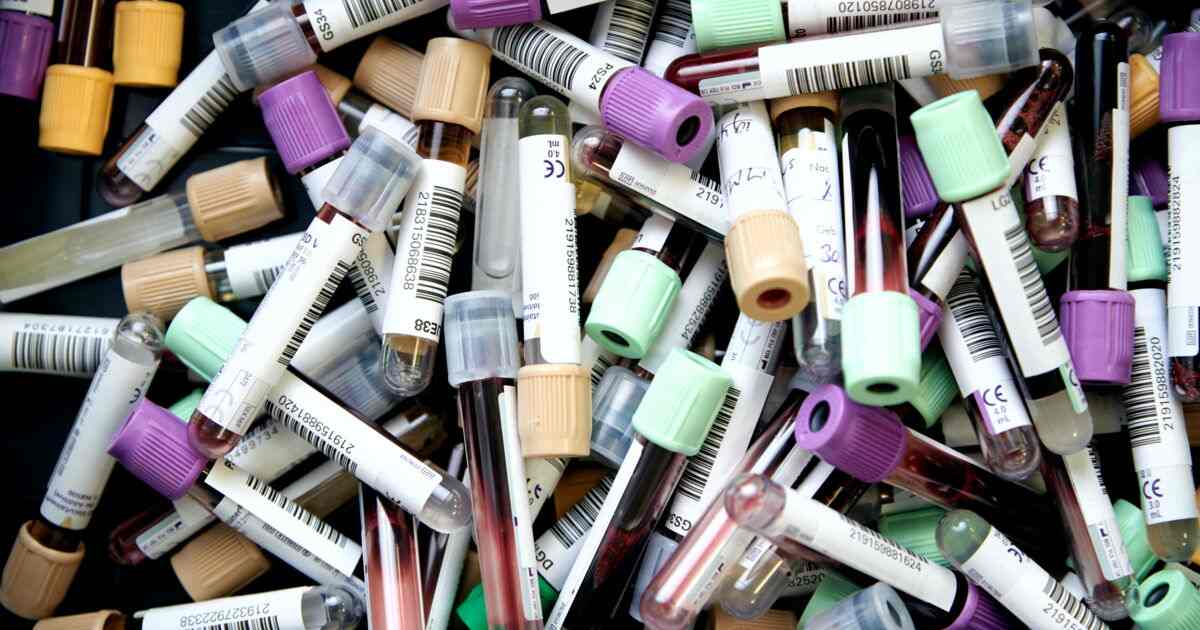 Il gruppo sanguigno che offre più benefici secondo la scienza