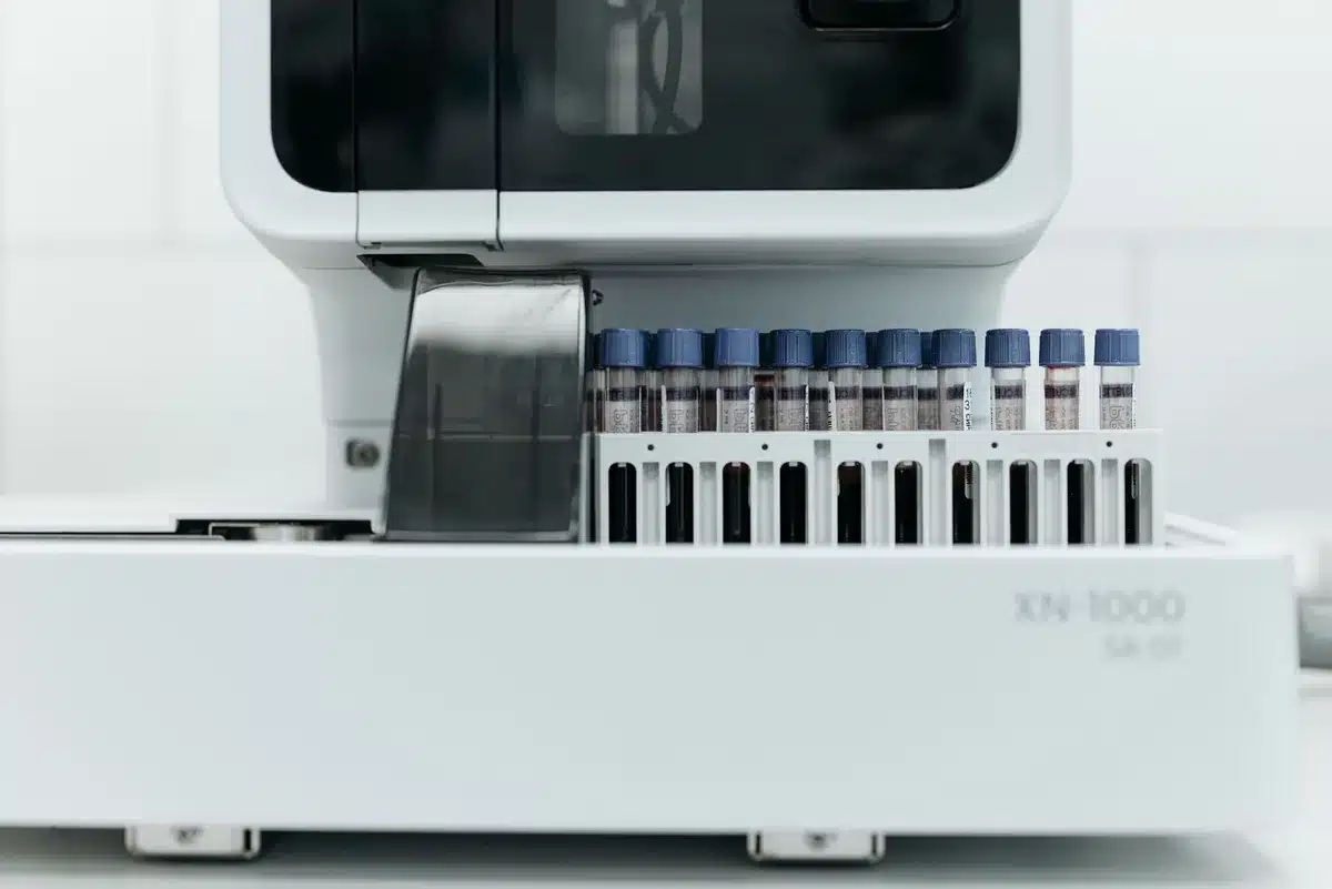 Attrezzature diagnostiche in laboratorio per test immunodiagnostici